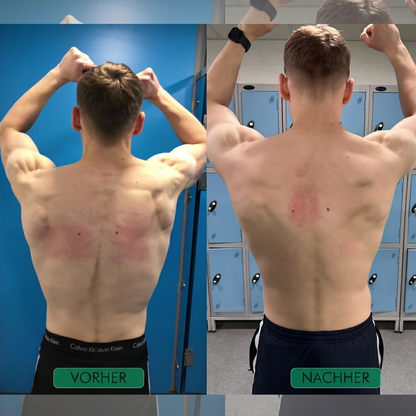 Alignmate, bessere Haltung in 30 Tagen